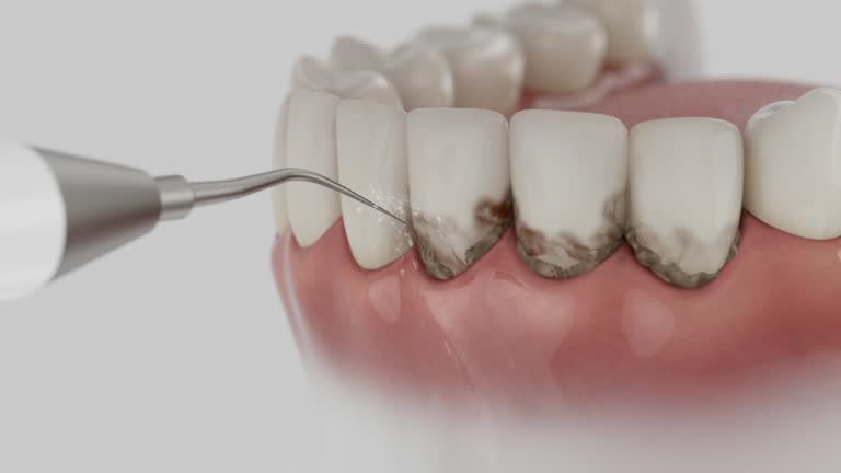 Reliable Dental Implants contractor in Redland, TX by Smile Center Dentistry